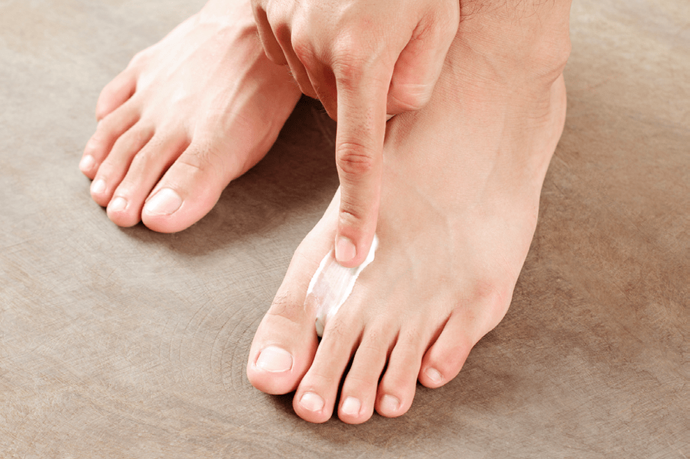 treating the fungus between the toes with ointment