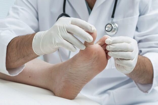 diagnosis of foot fungus at the doctor
