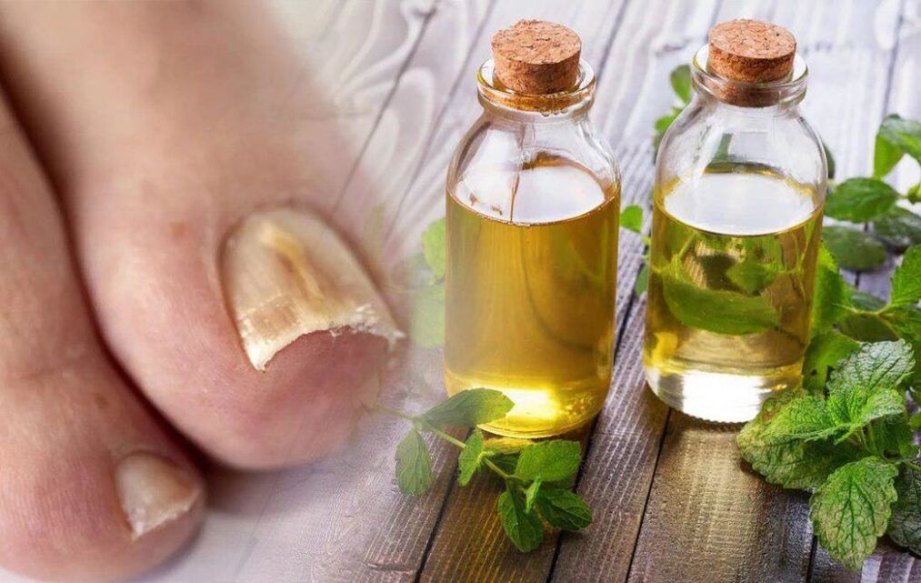 vinegar for nail fungus