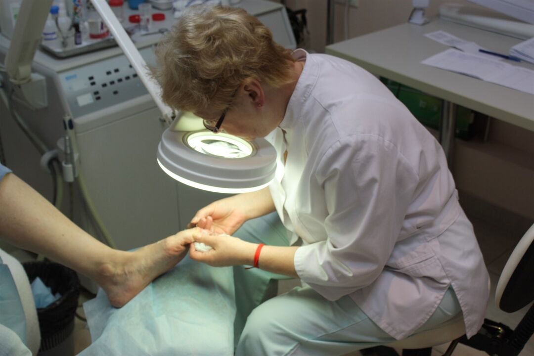 The impressive development of toenail fungus requires the help of a surgeon